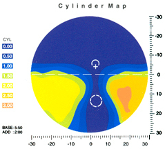 Vartek Chart